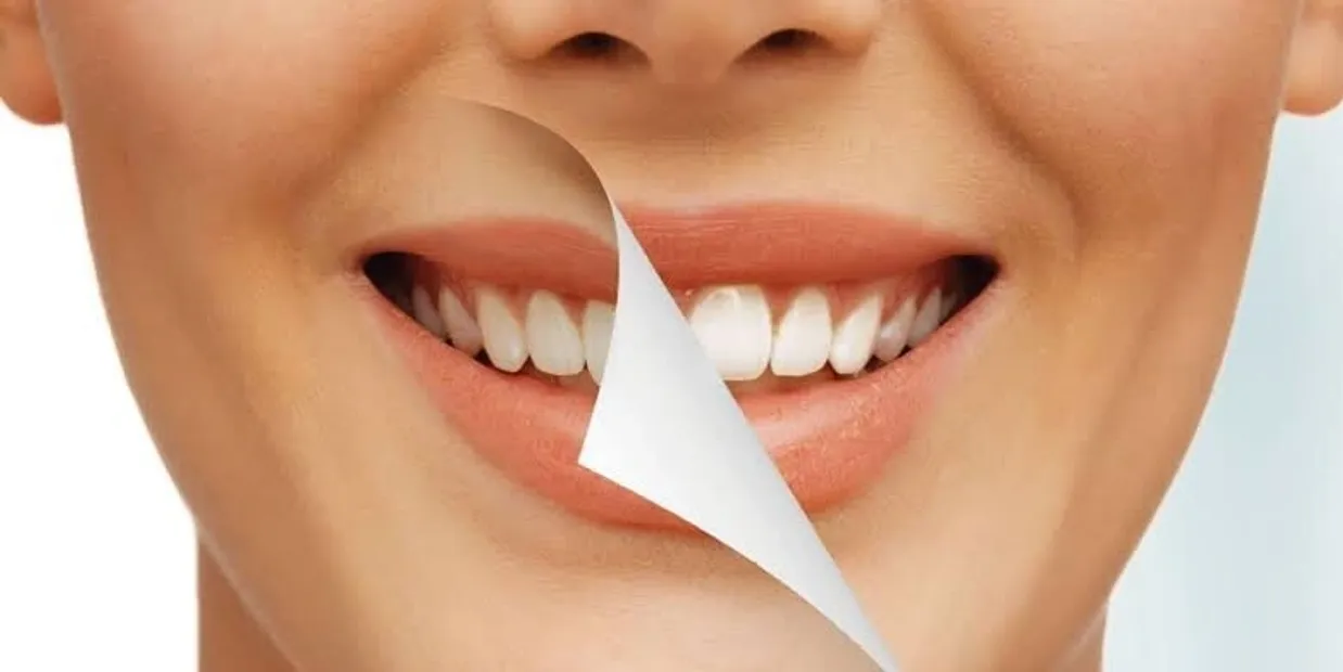 Can Laser Teeth Whitening Damage Your Dental Crowns Chester?