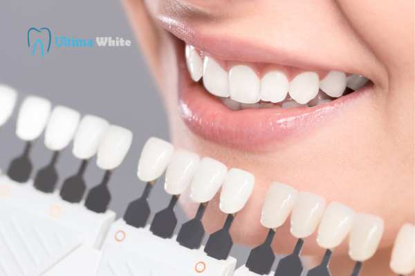 How to Maximise the Results of Your Laser Teeth Whitening Treatment Chester