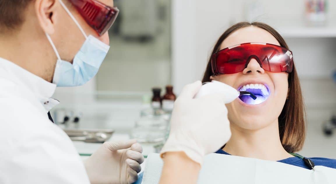 Do Dental Crowns Change Colour After Teeth Whitening Chester?
