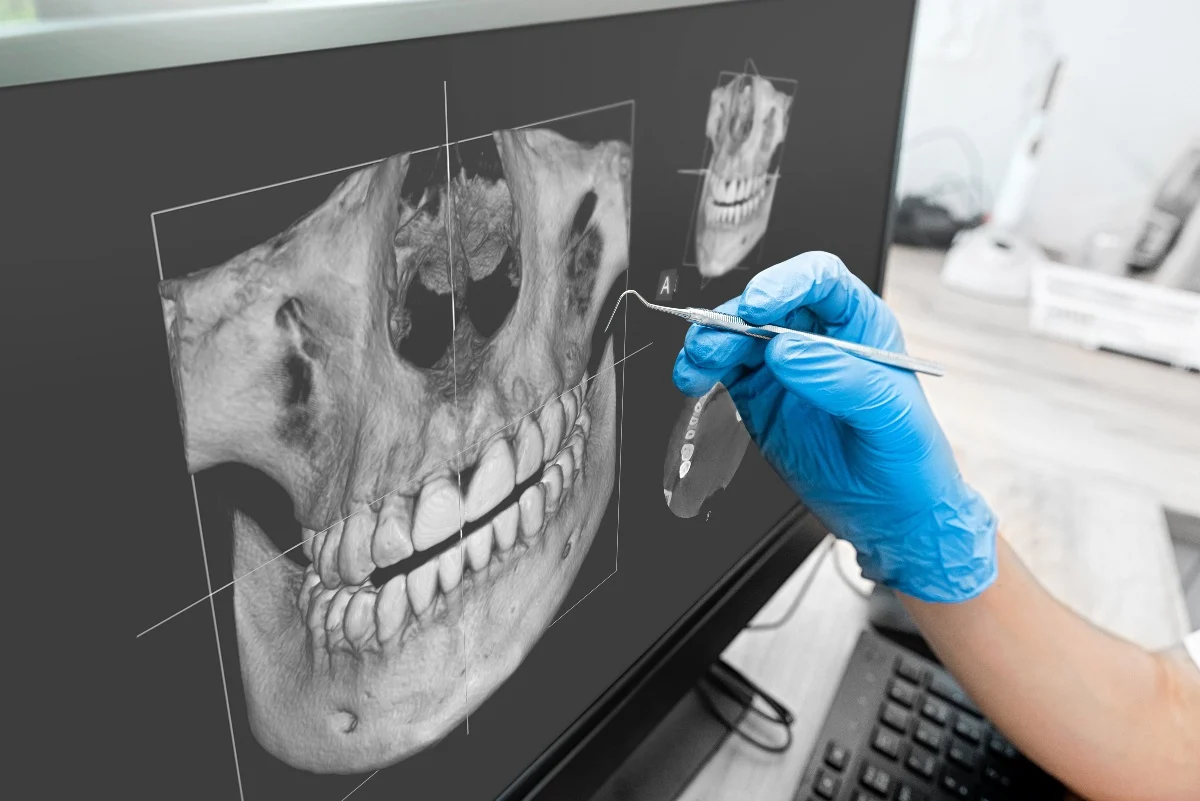 Key Benefits of 3D Printing for Patients and Dentists Chester