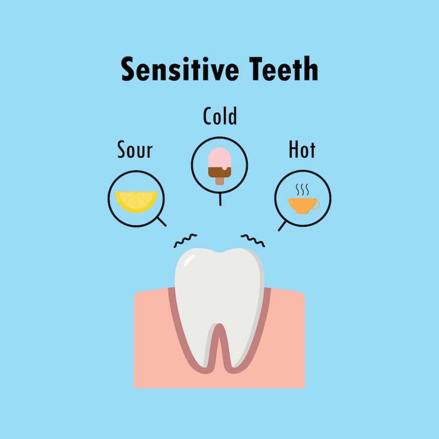 Why Do Teeth Become Sensitive After Whitening Treatments Chester?