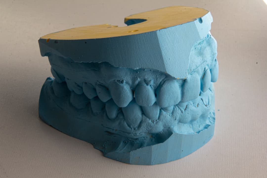 How Do Dental Implants Improve Jawbone Health and Oral Function Chester?