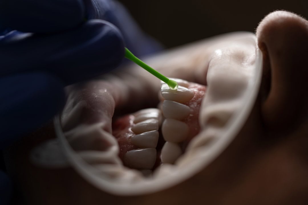 How Saliva Protects Your Teeth and Gums Chester