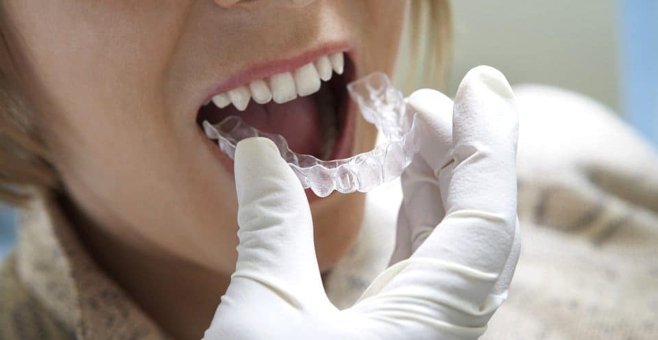 Can Bruxism Affect Your Sleep Quality Chester