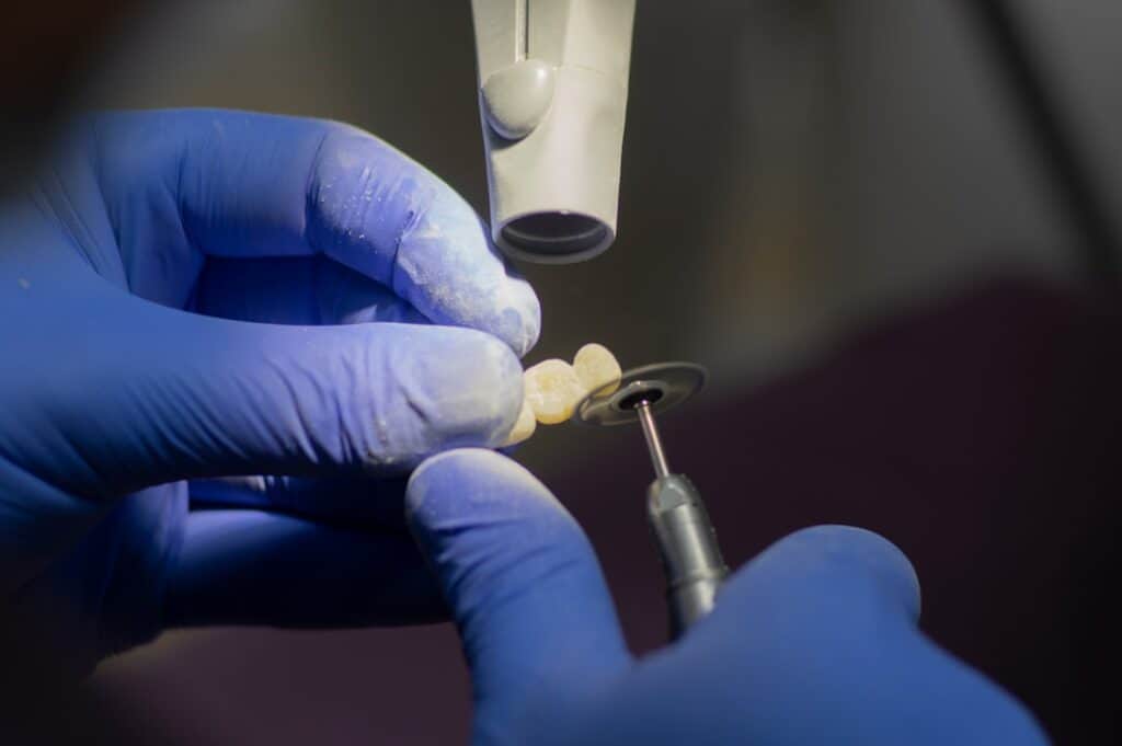 Customised Dental Solutions: Crowns, Aligners, and Implants Chester