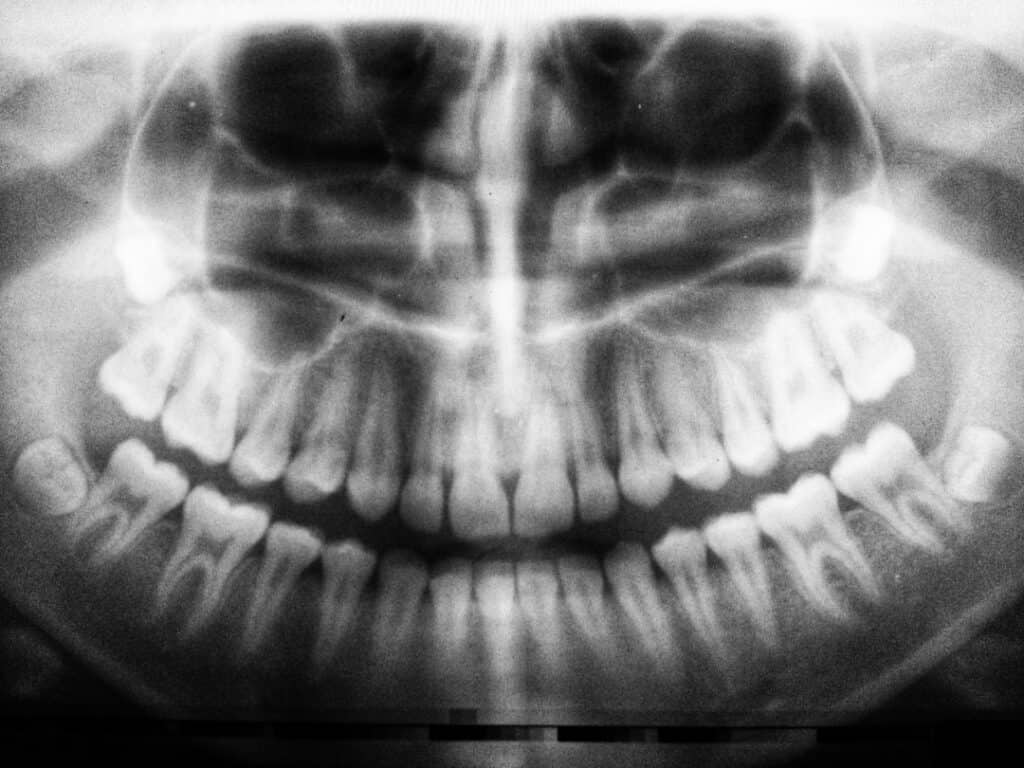 The Future of 3D Printing in Oral Healthcare Chester